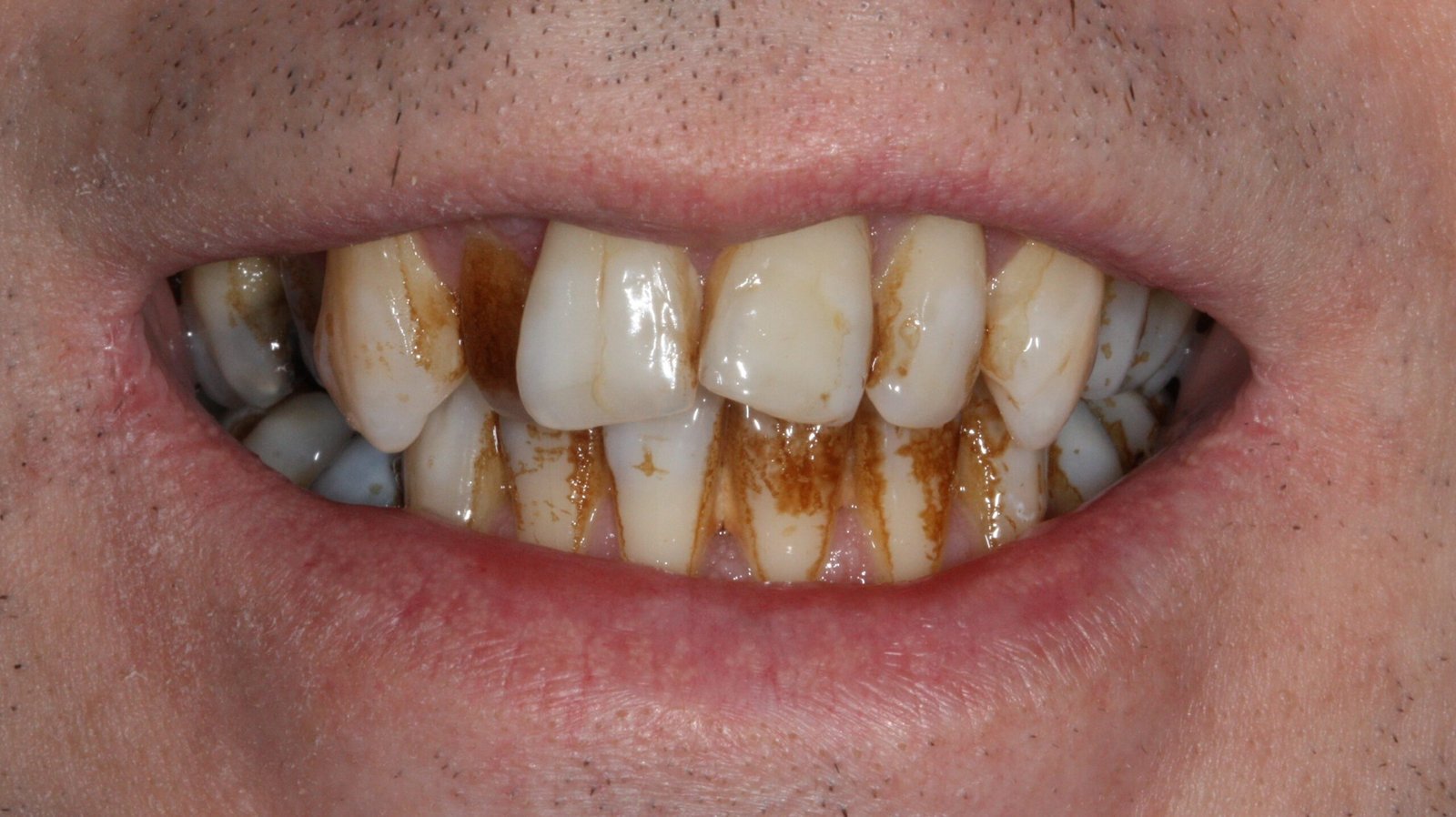 Airflow Before Airflow Before