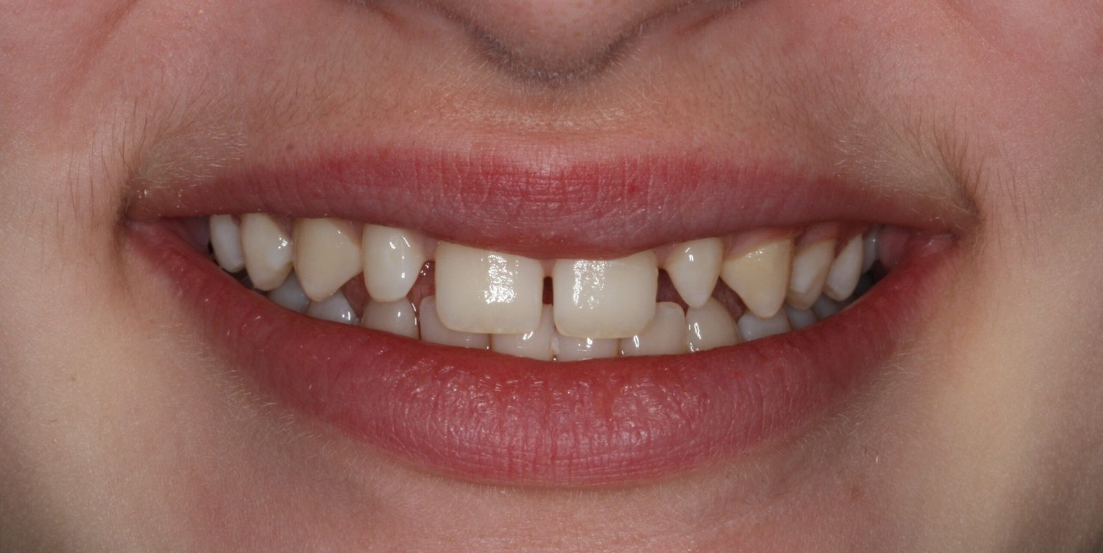 Before (1) Before (1)